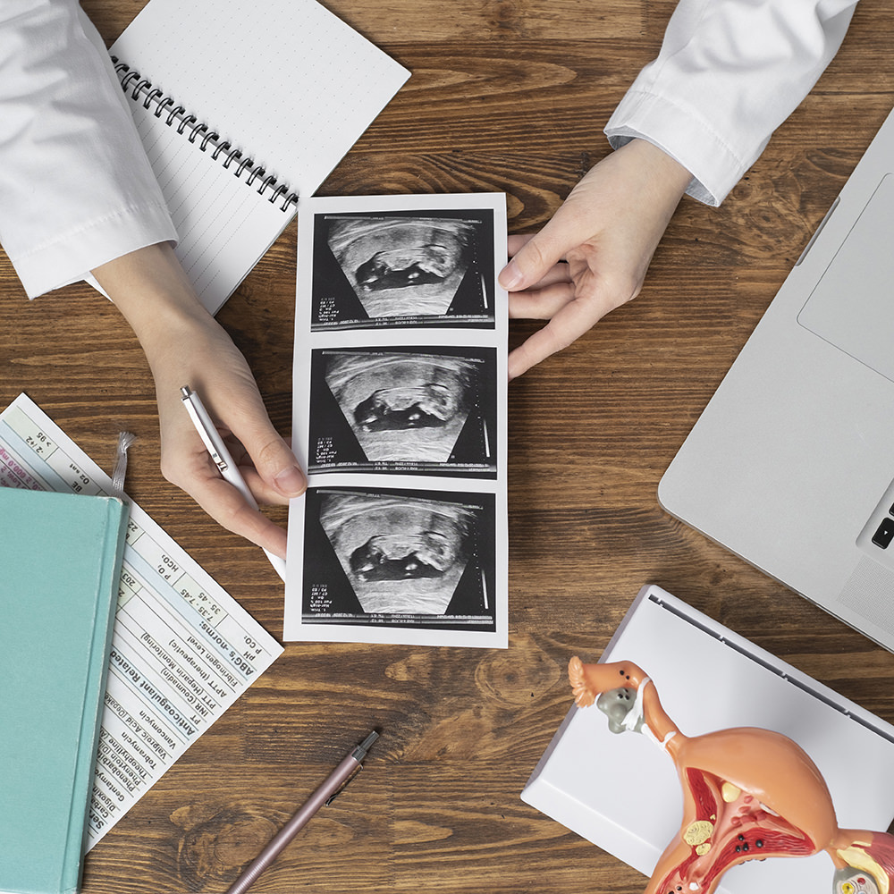 Obstetrician analysing ultrasound images.